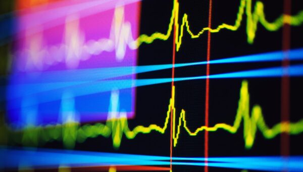 Здоровье сердца: шесть из десяти госпитализаций связаны с ишемической сердечной недостаточностью