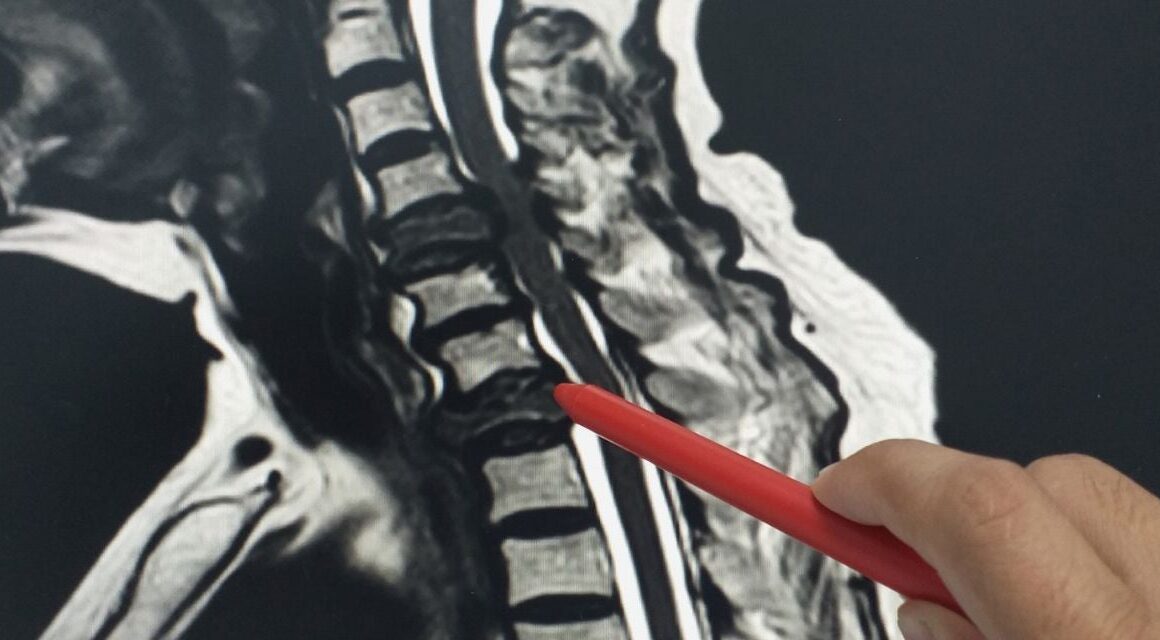 Коли призначають МРТ хребта